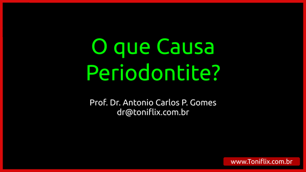 O que causa periodontite? Entendendo os fatores etiológicos